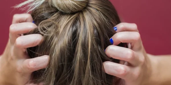 علاج أمراض الشعر