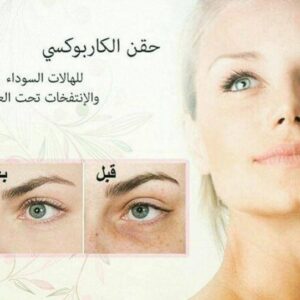 الكاربوكسي لعلاج الهالات السوداء